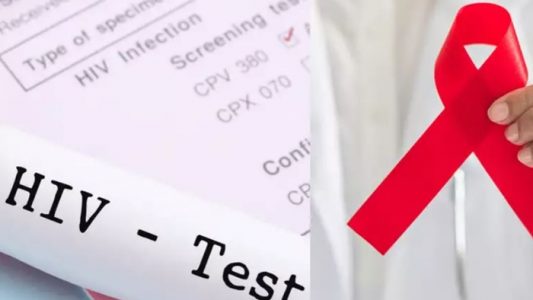 test hiv